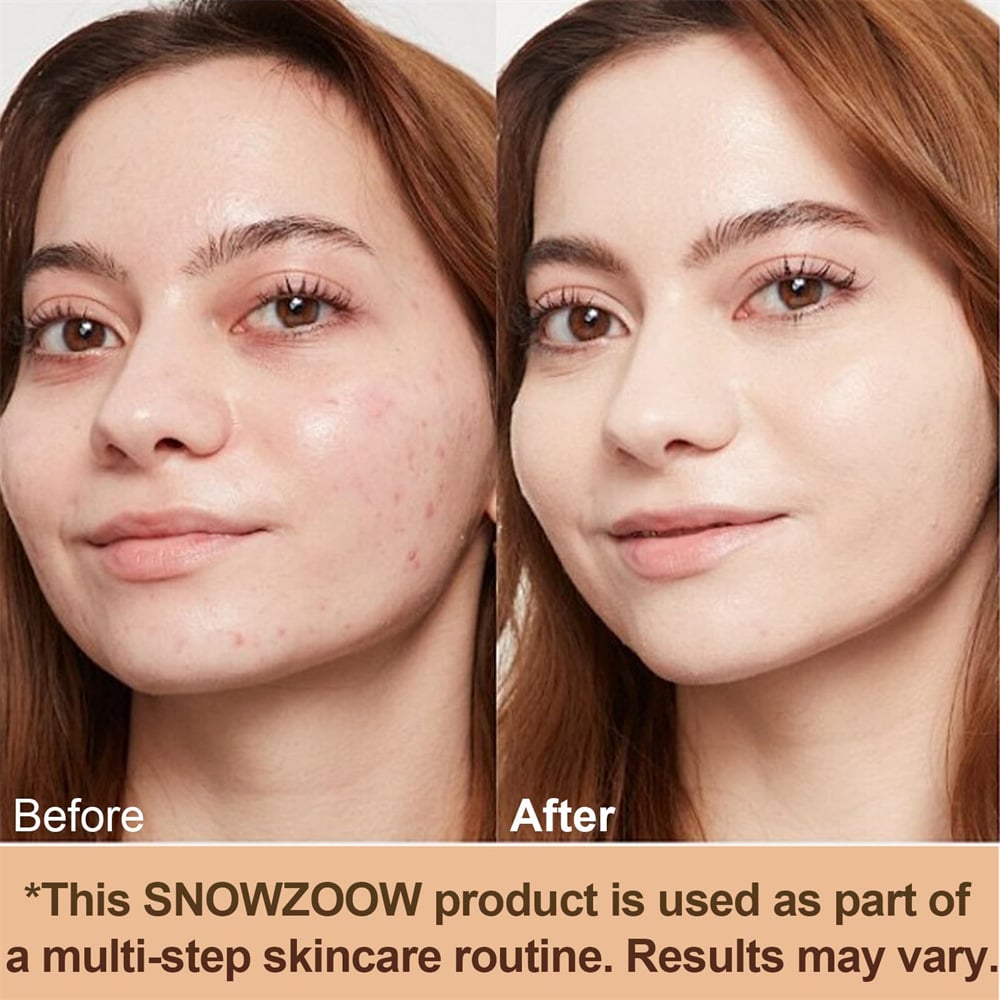 🔥Buy 2 Get 1 Free🎁 NEENCE® Foundation 4 in 1 - Light Spectrum