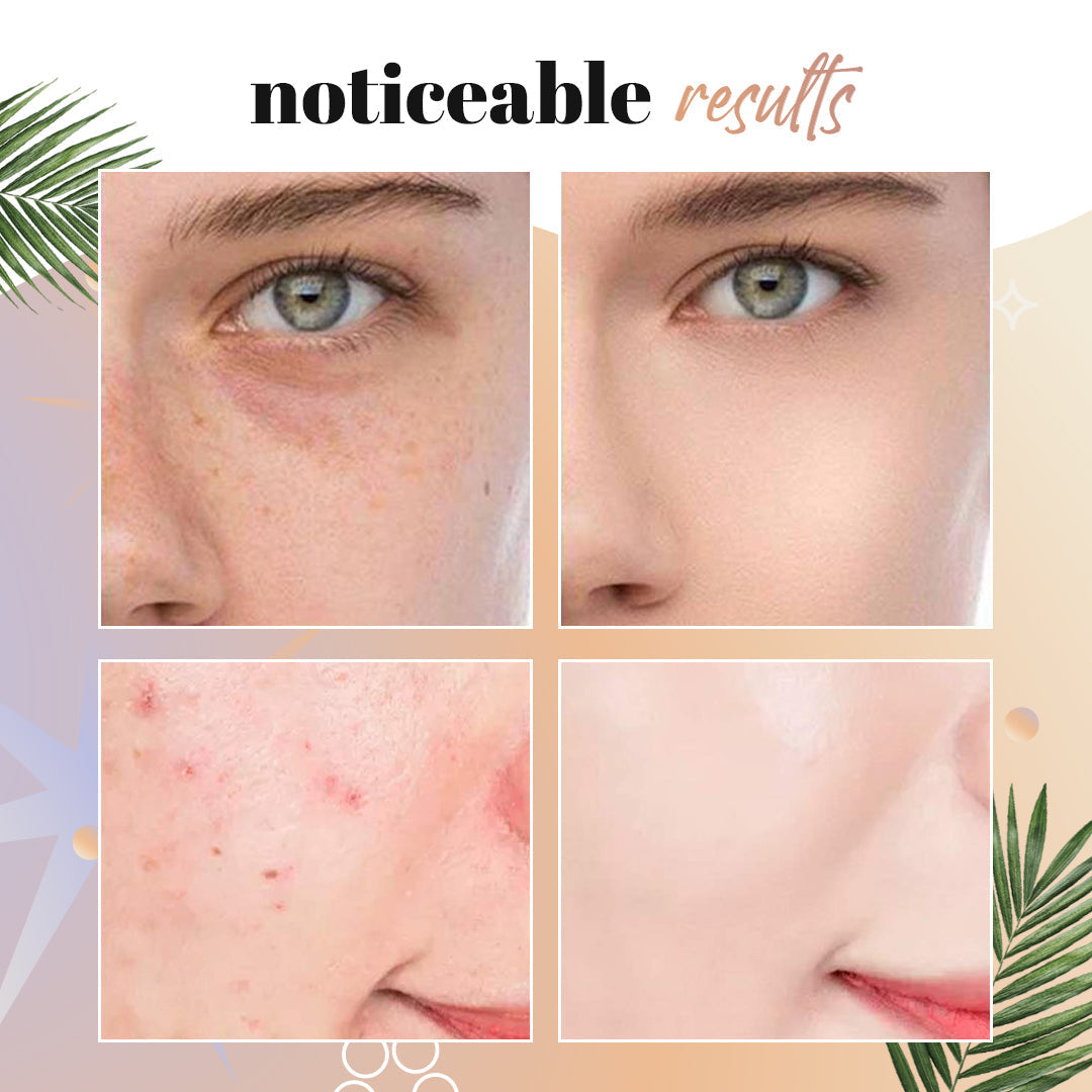 💖BUY 1 GET 1 FREE⏰ - NEENCE® Mushroom Head Air Cushion CC Cream