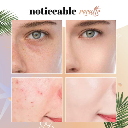 🎁BUY 1 GET 1 FREE⏰ - NEENCE® Mushroom Head Air Cushion CC Cream