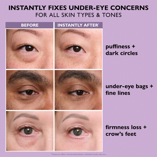 NEENCE® 🎁Last 3 hours: 70% off💜Instant Firming Eye Serum